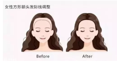 發(fā)際線粉填充和發(fā)際線筆哪個(gè)好？配合使用才最完美