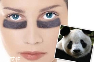 黑眼圈很重是什么原因？深扒三類黑眼圈的成因