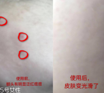 資生堂紅腰子適合什么年齡？最適合30歲以下人群