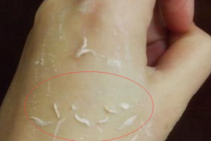 去角質(zhì)凝露多久用一次？皮厚一周一次