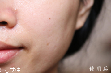 悅木之源和伊麗莎白雅頓哪個好？兩款精華大比拼