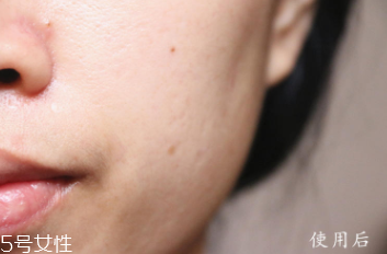 悅木之源和伊麗莎白雅頓哪個好？兩款精華大比拼