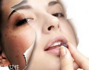 春季如何預(yù)防皮膚過(guò)敏？選擇敏感肌專用護(hù)膚品