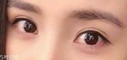 葉黃素能治療夜盲癥嗎？看什么類型的