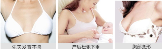 豐胸霜怎么用？豐胸霜使用手法詳解