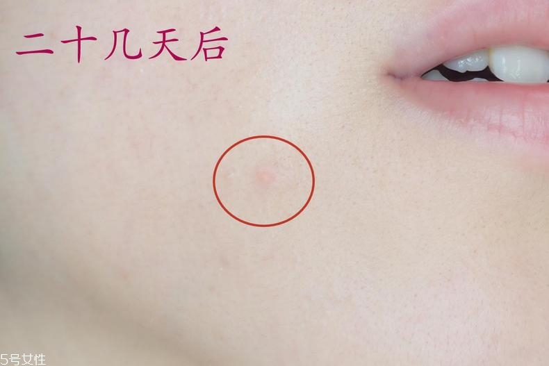 雅詩蘭黛晶透沁白防曬搖搖乳成膜快嗎？適合油痘皮嗎？
