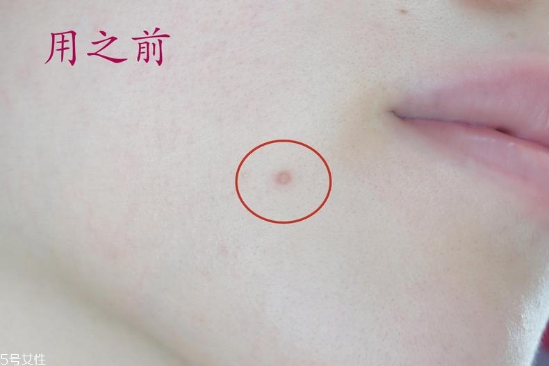 雅詩蘭黛晶透沁白防曬搖搖乳成膜快嗎？適合油痘皮嗎？