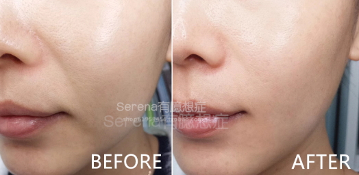 dermawand逆齡射頻注氧棒怎么用？