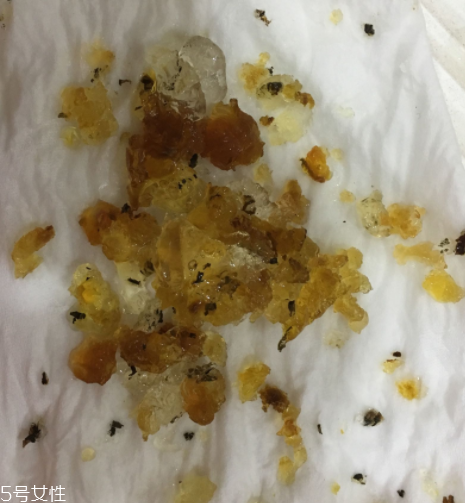 桃膠能和雞蛋一起吃嗎？桃膠配雞蛋可以嗎？