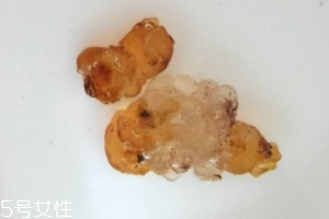 桃膠可以用開水泡嗎？用開水泡桃膠好嗎？