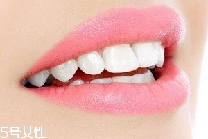 超聲波潔牙牙齒會變白嗎？超聲波潔牙心得