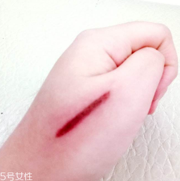 創(chuàng)可貼和肉連著怎么辦？創(chuàng)可貼連著肉怎么處理？