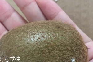 綠心獼猴桃含葉酸嗎？綠心獼猴桃里面有葉酸嗎？