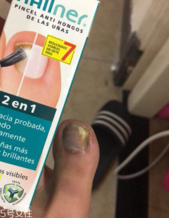 灰甲清有副作用嗎？灰甲清有哪些副作用？