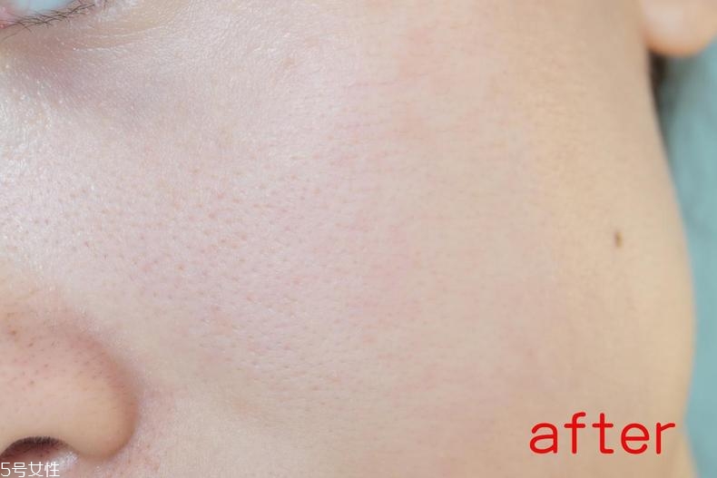 radha beauty vc精華白天能用嗎？敏感肌能用嗎？