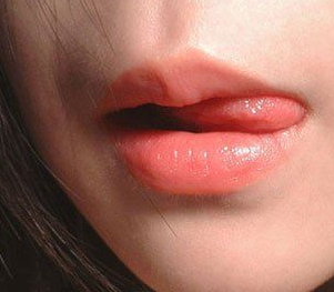 兔唇修復(fù)要多少錢？兔唇修復(fù)風(fēng)險(xiǎn)大嗎