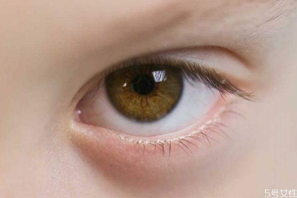 開(kāi)內(nèi)眼角危險(xiǎn)嗎 開(kāi)內(nèi)眼角好不好