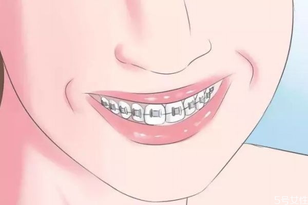 敏感牙齒怎么做脫敏治療呢 牙齒脫敏治療需要多少錢(qián)呢