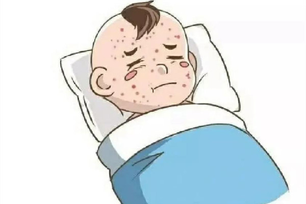 水痘進(jìn)入高發(fā)期專家提醒 水痘的癥狀和治療