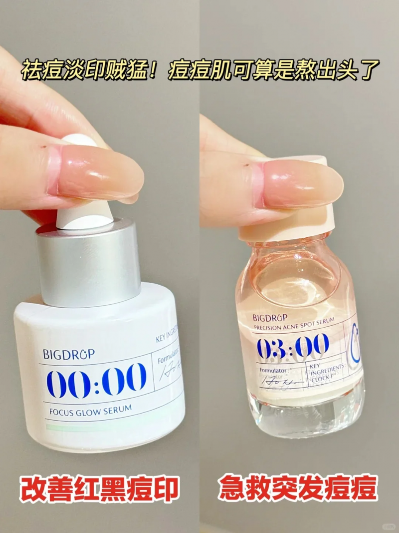 祛痘產(chǎn)品橫測：谷雨白千祛痘凝膠、大水滴與達(dá)爾膚杏仁酸，誰是祛痘王者？